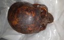 Cực nóng: Tìm ra đầu xác ướp 800 tuổi mới bị đánh cắp 