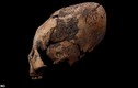 Vì sao người xưa "nghiện" biến dạng hộp sọ thành hình quả trứng? 