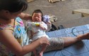 Vụ trẻ sơ sinh gãy tay: không có quyền bắt đền BV?