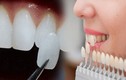 Tác hại đáng sợ của việc mài răng trước khi bọc răng sứ