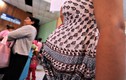 Thai phụ nhiễm virus Zika ăn não người có phải bỏ thai?