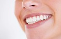 Bí quyết đơn giản để có hàm răng trắng xinh đón Tết