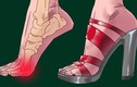 3 bộ phận cơ thể "lâm nguy" khi bạn đi giày cao gót quá nhiều