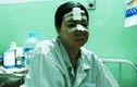 Một phụ nữ bị nhóm đánh ghen rạch nát mặt