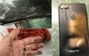 Video: iPhone XS Max đột nhiên phát nổ ngay trong túi quần