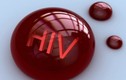 Cần làm gì khi bị dính máu nghi nhiễm HIV?