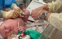 Chi tiết bệnh viện Việt Nam chăm sóc bà bầu, trẻ sơ sinh
