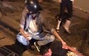 Nam thanh niên bị chém kinh hoàng giữa phố Hà Nội sau TNGT