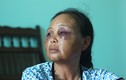 Lời kể của người phụ nữ bị đánh vì nghi bắt cóc trẻ em ở Hà Nội