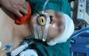 Hà Nội: Nam sinh bị đánh trọng thương ngay cửa nhà
