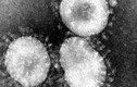 Phát hiện ca nhiễm dịch bệnh COVID-19 đầu tiên tại châu Phi