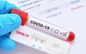 Lật hồ sơ Y tế Đức Minh nhập khẩu kit xét nghiệm COVID-19 “khủng” hơn Việt Á