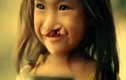 Nụ cười bé gái hở hàm ếch trong thước phim cảm động