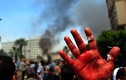 Những hình ảnh về trấn áp đẫm máu ở Cairo 