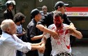 Cảnh sát giải tán biểu tình ở Cairo, 120 người thương vong
