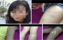 Bắc Ninh: Giáo viên chủ nhiệm đánh học sinh dã man?
