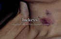 Hickey Kiss, trào lưu hôn rợn người của các cặp đôi