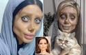 Phát hoảng khuôn mặt “xác ướp” của cô gái 50 lần phẫu thuật