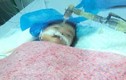 Chủ tịch Hà Nội yêu cầu Công an điều tra vụ bé 8 tháng tuổi tử vong do bị tiêm nhầm