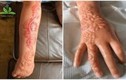 Mê mẩn trào lưu xăm henna, giới trẻ phải chịu hệ lụy