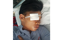 Quảng Bình: “Hổ báo” với đàn anh, trai làng bị chém gục tại quán nước