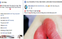Hàng loạt Facebook mạo danh bác sĩ Bệnh viện 108 lừa đảo