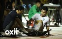Văn Thanh chấn thương chia tay AFF Cup 2018, thầy Park đau đầu
