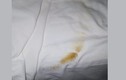 Phẫn nộ cặp vợ chồng thuê khách sạn 5 sao lại còn “phóng uế” lên giường