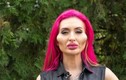 Tiêm filler quá đà, người mẫu Ukraine khiến người nhìn “dựng tóc gáy“