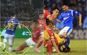 Trước Đỗ Hùng Dũng, V-League từng chứng kiến bao vụ gẫy chân?