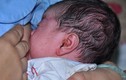 Kinh hãi phát hiện giòi trong tai trẻ sơ sinh