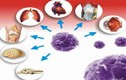 Tế bào gốc chữa được những bệnh nào?