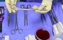 Bác sĩ "mổ" trộm heroin trong dạ dày bệnh nhân