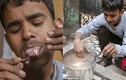 Cậu bé “dị nhân” Ấn Độ chịu được điện áp 11.000V 