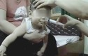 Cha mẹ dùng xilanh xịt rửa mũi cho trẻ - tác hại khôn lường