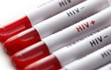 3 trẻ nghi bị phơi nhiễm HIV do bị đối tượng ngáo đá tấn công