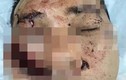 Diễn viên Hoàng Tuấn Phong bị chém 3 nhát vào mặt, bất tỉnh tại chỗ 