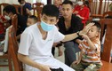 70 trẻ bị dị tật mắt tại Vĩnh Phúc được khám miễn phí