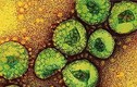 Virus “tử thần” MERS-CoV nguy hiểm như thế nào?