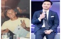 MC Thành Trung bị soi gương mặt quá khác lạ nghi do 'dao kéo'