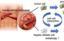 Tìm ra phương thức mới để ngăn ngừa ung thư gan