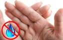 7 biểu hiện lạ trên bàn tay cảnh báo sức khỏe của bạn