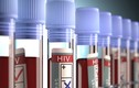 Rúng động sản phụ 9 lần bị chẩn đoán nhầm nhiễm HIV