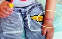 Bé 4 tuổi đeo chun vòng bị nghẽn mạch máu