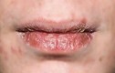 Video: Nẻ môi, sụp mí... dấu hiệu của hàng loạt bệnh nguy hiểm