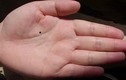 Video: Bói nốt ruồi trong lòng bàn tay chuẩn xác