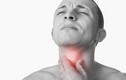 Video: Dấu hiệu rõ mười mươi của ung thư cổ họng
