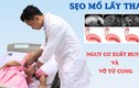 Sản phụ 40 tuổi thai bám ở sẹo mổ nguy hiểm tính mạng