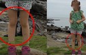 Bí ẩn “đôi chân ma” xuất hiện trong ảnh chụp bé gái