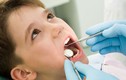 Top sai lầm tệ hại khi chăm sóc răng miệng cho con